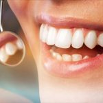 ¿Cuál es el proceso para colocar un implante dental?