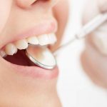 Dientes fuera de la boca: ¿pueden crecer así?