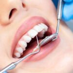 Claves para evitar la periodontitis