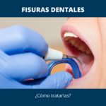 Fisuras dentales: ¿Cómo tratarlas?